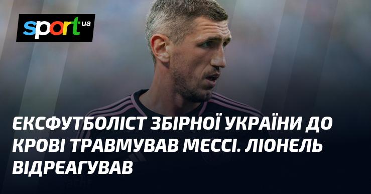 Колишній гравець збірної України завдав серйозної травми Мессі. Реакція Ліонеля не забарилася.